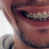 Bracesman1505