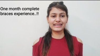 ll One month complete braces experience 🙂ll guys braces lgwane chahiye ya nhi..!!😒 #rastogiivlogs