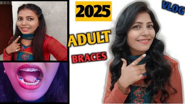 My Braces Journey || Adult Braces 2025 || Braces/ Nd Family Vlogs