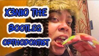 REMOVING MY BRACES (AT HOME) 😬