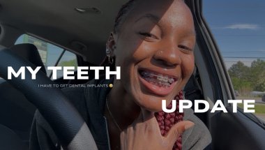 THE ORTHODONTIST TOLD ME 🥲🥺…