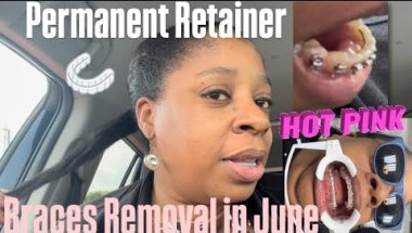 Braces Update: Permanent Retainer, Hot Pink Elastics, Braces Removal set for June