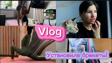 VLOG: ЭТОТ ДЕНЬ НАСТАЛ! УСТАНОВИЛА БРЕКЕТЫ НА РОВНЫЕ ЗУБЫ, ЗАЧЕМ? ПЕРВОЕ ДЗ НА ОБУЧЕНИИ