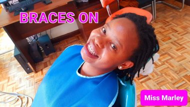 Getting Braces Today, is it Painful | The Big Reveal!