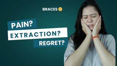 Braces Series (Episode 1): Braces Experience | Was it painful? | Teeth Extraction?