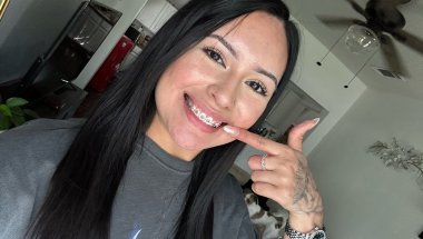 FINALLY GOT MY BRACES