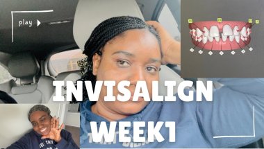 Is Invisalign Actually Worth It?