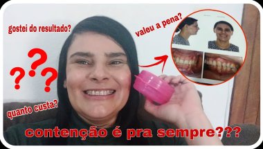 CONTEI TUDO SOBRE MINHA CONTENÇÃO E EXPERIÊNCIA COM APARELHO DENTAL| RELATO SINCERO, ME ARREPENDO?