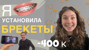 Я ПОСТАВИЛА БРЕКЕТЫ и удалила зубы *очень больно*