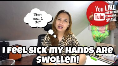 WHY MY HANDS ARE ALWAYS SWOLLEN EVERY MORNING? AM I SICK! A DAY IN MY LIFE!