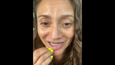 BRACES JOURNEY Update! Almost there! 😍✨️🤓 2nd to last appt! ❤️🦷 #braces #bracesjourney #adultbraces