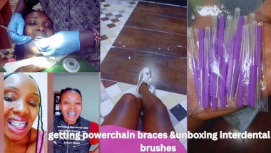 Braces check up\power chain braces & pain\journey with braces continues\unboxing interdental brushes