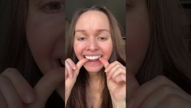 Снятие брекетов
