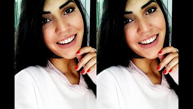 APARELHO MÓVEL DÓI ?😥 DÚVIDAS E DICAS   - REALCE SUA BELEZA