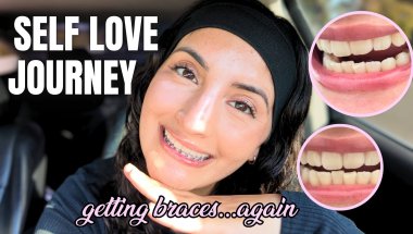 GETTING BRACES AGAIN -Self Love Journey ♡