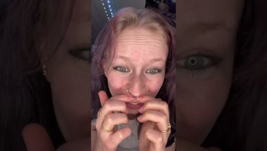 My new retainers #trending #fy #viralvideos