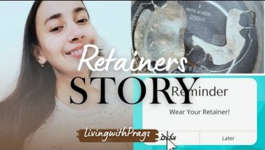 THE RETAINER STORY #retainers #braces #orthodontics #teeth #gums #retainer