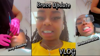 Come With Me to Get My braces Adjusted #adayinmylife #braceslife #viralvideo #contentcreator