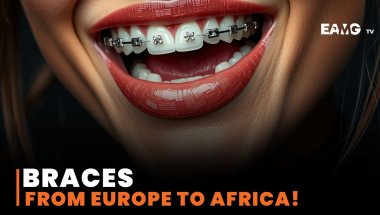 How Braces Were Invented — And How They Came to Africa
