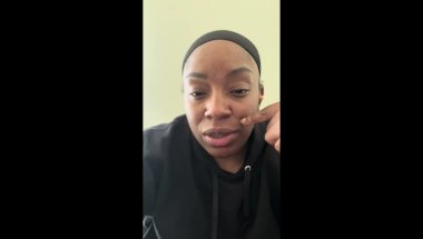 22/23 Month Adult Braces Update