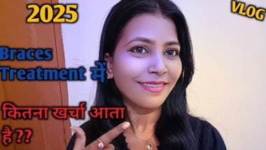 Braces Cost in India | Braces Cost 2025 | Types Of Braces | #bracescost #braces #bracesupdate