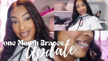 1 MONTH BRACES UPDATE || GOT NEW WIRE AND PURPLE COLORED RUBBER BANDS