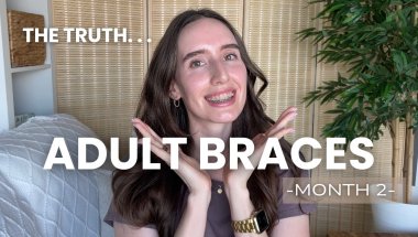 Adult Braces 101: Month 2 Reality - Adjustments, Pain & First Cleaning