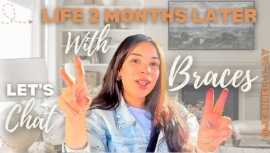 Life with Braces | Update 2 Months Later
