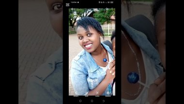 MY JOURNEY WITH BRACES ,PROS AND CONS OF HAVING BRACES......