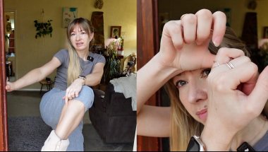 Things You Don’t Know About Me - Scars I Have!