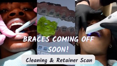 Pre-Braces Removal Vlog | Teeth Cleaning + Retainer Scan Before the Big Day! #bracesjourney