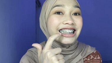 kontrol behel ke-27 | pakai karet elastis