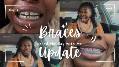 Braces Update #3: Tongue Tamers Are the WORST + Life Lately 💬🖤