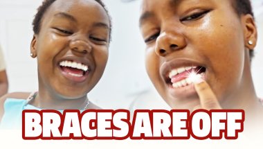Mumbus Gets Her Braces Off | The Big Reveal!