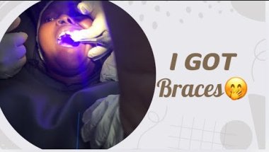Getting Braces @ 33 🫢 | Self Love Journey #health #dental #southafrica #sunset