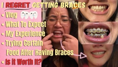 25 Things I Learned While Having Braces | Vlog + What it’s like to have braces + My worst experience