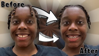 COME WITH ME TO GET BRACES 😬!