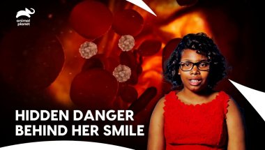 When Braces Trigger a Deadly Medical Mystery | Monsters Inside Me | Animal Planet