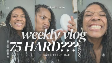 Braces OFF, Wearing a Retainer, Starting 75 HARD + Charlotte Photoshoot! ⋆˙⟡♡