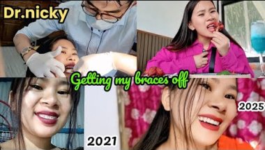Getting my braces off//after 4 years😁