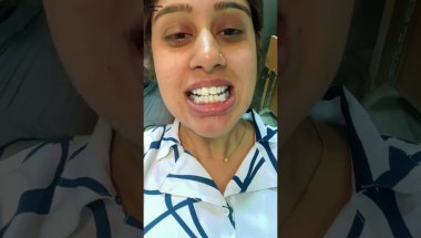 दाँतों में तार कैसे लगते हैं? | मेरा पहला Orthodontic Experience | @NaveenPahadiVlogs