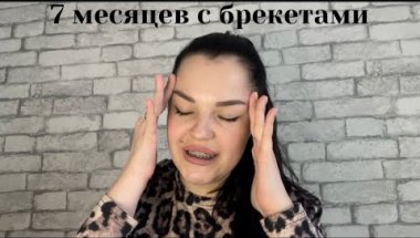 ЖАЛЕЮ ЛИ Я 🥹 ЧТО ПОСТАВИЛА БРЕКЕТЫ ?!