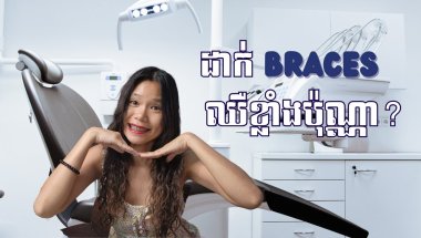 មកដាក់ braces ជាមួយខ្ញុំ