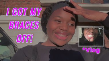 GETTING MY BRACES OFF?! *after 4 years*