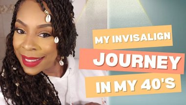 MY INVISALIGN JOURNEY IN MY 40'S😬LET'S SEE IF THIS 💩 REALLY WORKS...🙄