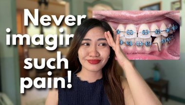 Top 5 most painful things about braces | My personal experience