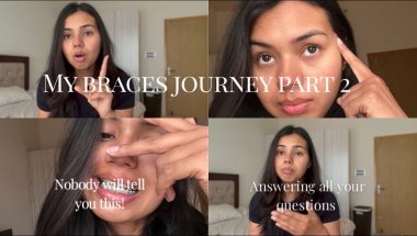 Braces Struggles & Secrets 🤐 | Full Q&A