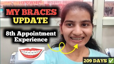 Getting Used to Power Chains: My 8th Braces Adjustment❗