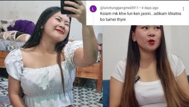 My braces journey