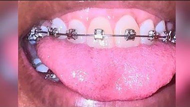 A LOOK INSIDE THE MOUTH AFTER EATING